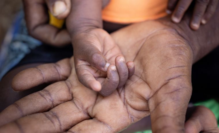 Cyclone Gezani à Madagascar : la solidarité est en marche !